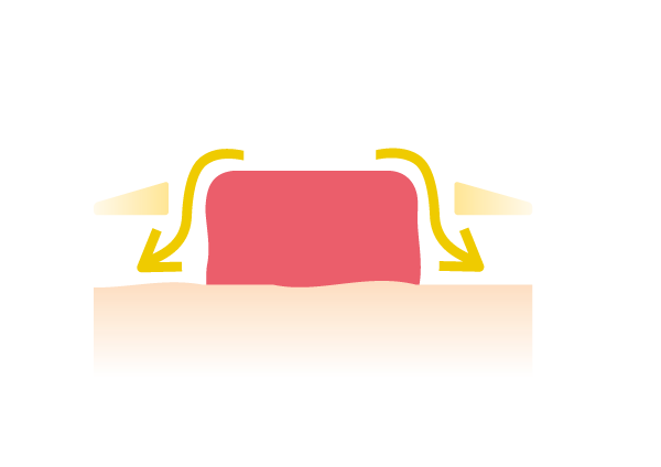 <center>En cas de rupture de l’adhésif de votre support