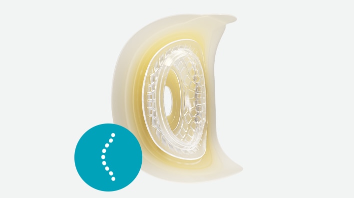 Sensura® Mio Convex Fit <br><b>Support convexe souple</b>