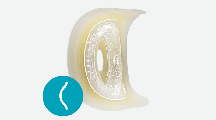 Sensura® Mio Convex Fit <br><b> Semi-convexe</b>