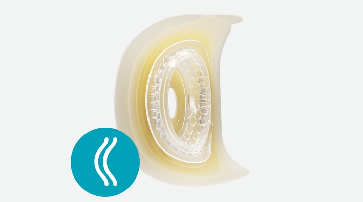 Sensura® Mio Convex Fit <br><b>Convexe profond</b>