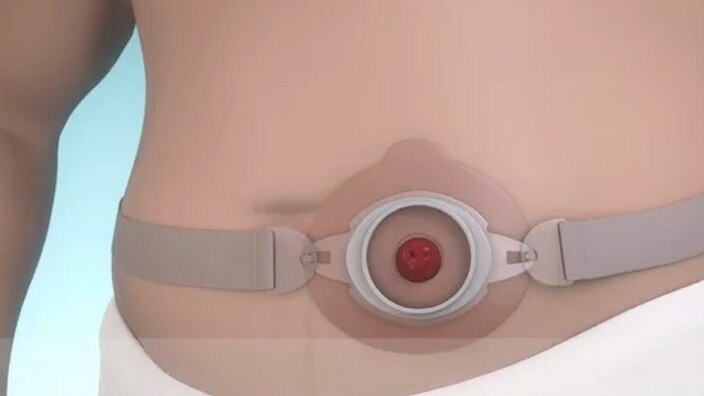 Guide d'utilisation vidéo de la ceinture Brava