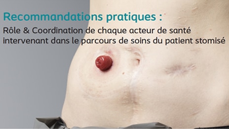 Guide des recommandations de la prise en charge des patients stomisés